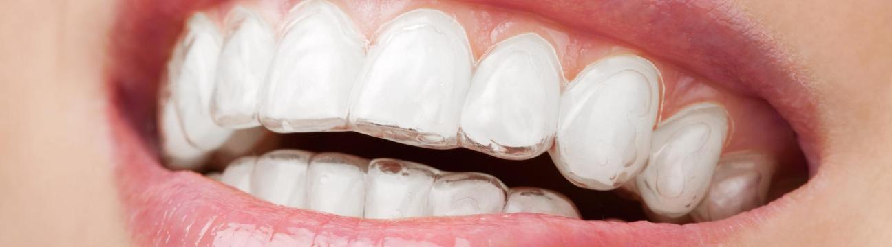 Caring for Your New Smile