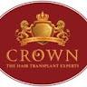 crownhairtransplant